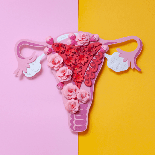Endometriosis